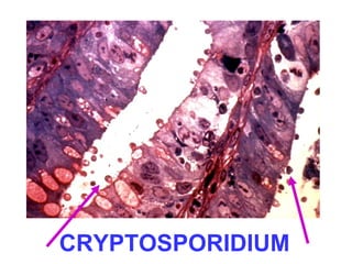 CRYPTOSPORIDIUM 
 