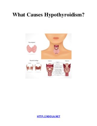 HTTP://ADOLA.NET 
What Causes Hypothyroidism? 
 