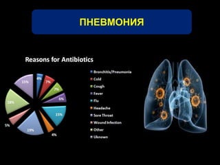 ПНЕВМОНИЯ 
 