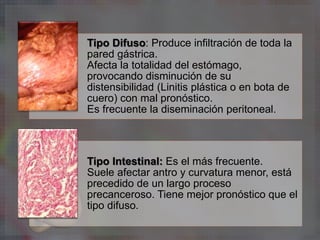 Tipo Difuso: Produce infiltración de toda la
pared gástrica.
Afecta la totalidad del estómago,
provocando disminución de su
distensibilidad (Linitis plástica o en bota de
cuero) con mal pronóstico.
Es frecuente la diseminación peritoneal.
Tipo Intestinal: Es el más frecuente.
Suele afectar antro y curvatura menor, está
precedido de un largo proceso
precanceroso. Tiene mejor pronóstico que el
tipo difuso.
 