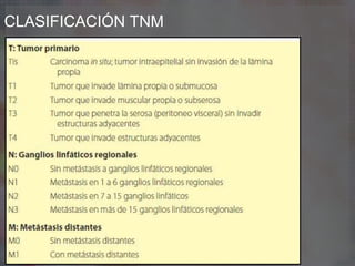 CLASIFICACIÓN TNM
 
