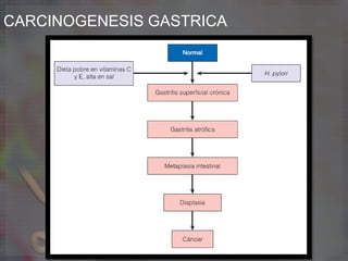 CARCINOGENESIS GASTRICA
 