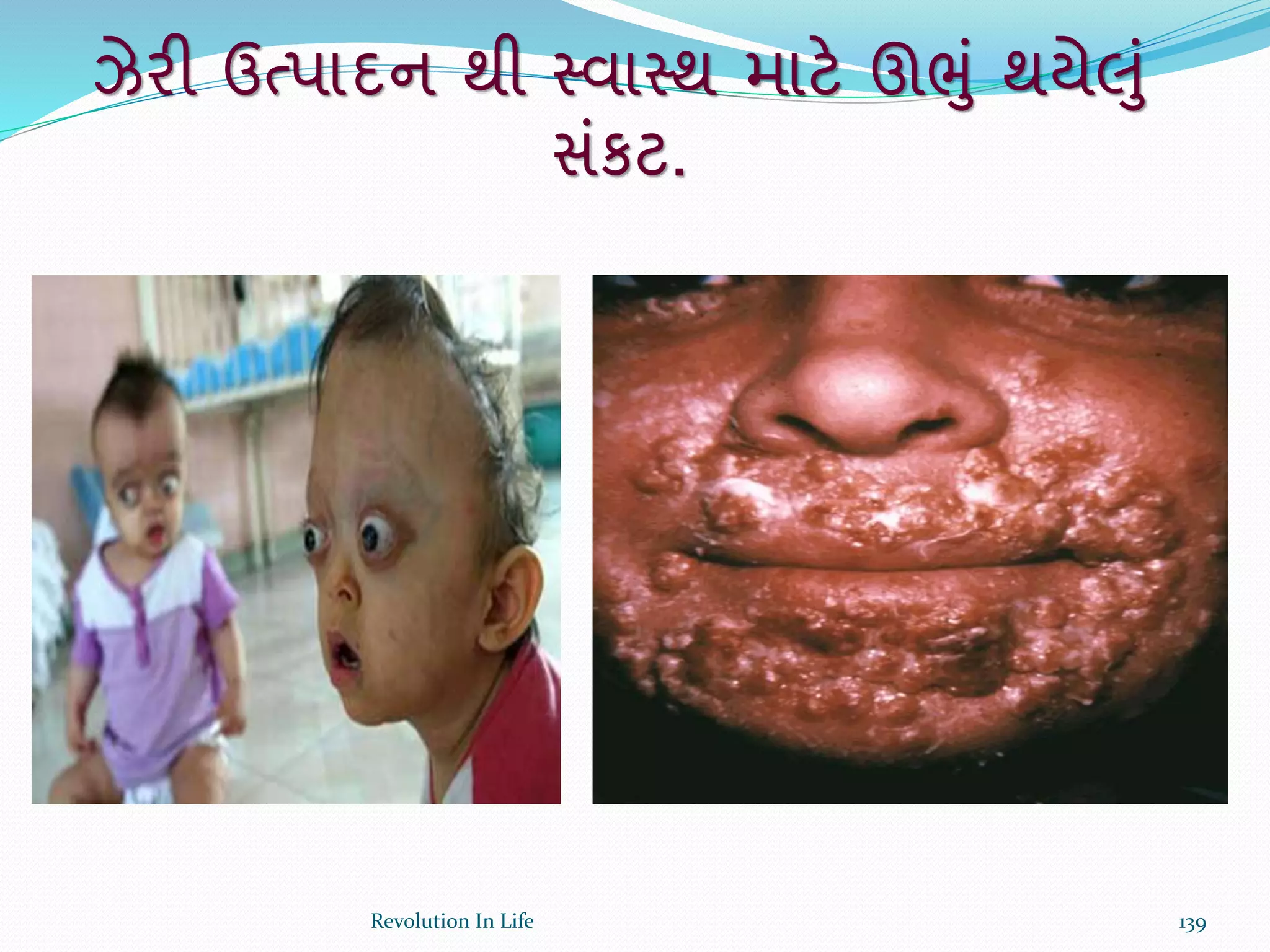 ઝેરી ઉત્પાદન થી સ્વાસ્થ માટે ઊભું થયેલું
સંકટ.
139Revolution In Life
 