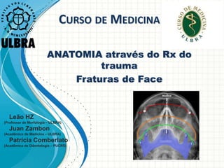 CURSO DE MEDICINA
ANATOMIA através do Rx do
trauma
Fraturas de Face
Leão HZ
(Professor de Morfologia – ULBRA)
Juan Zambon
(Acadêmico de Medicina – ULBRA)
Patrícia Comberlato
(Acadêmica de Odontologia – PUCRS)
 