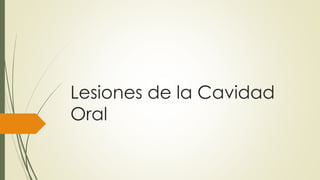 Lesiones de la Cavidad
Oral
 