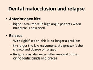 Dental malocclusion and relapse
• Anterior open bite
– higher occurrence in high angle patients when
mandible is advanced
• Relapse
– With rigid fixation, this is no longer a problem
– the larger the jaw movement, the greater is the
chance and degree of relapse
– Relapse may also occur after removal of the
orthodontic bands and braces
 