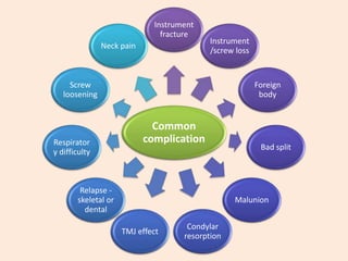 Common
complication
Instrument
fracture
Instrument
/screw loss
Foreign
body
Bad split
Malunion
Condylar
resorption
TMJ effect
Relapse -
skeletal or
dental
Respirator
y difficulty
Screw
loosening
Neck pain
 