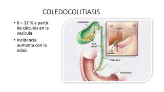 COLEDOCOLITIASIS
• Ecografía
Ictericia + dolor biliar + colédoco > 8 mm:
lo sugiere
• Colangiografia de resonancia magnéti...
