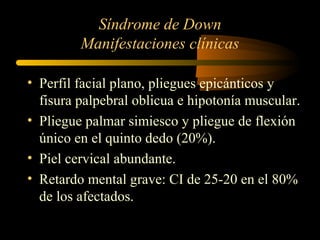 Síndrome de Down
Manifestaciones clínicas
• Perfil facial plano, pliegues epicánticos y
fisura palpebral oblicua e hipotonía muscular.
• Pliegue palmar simiesco y pliegue de flexión
único en el quinto dedo (20%).
• Piel cervical abundante.
• Retardo mental grave: CI de 25-20 en el 80%
de los afectados.
 