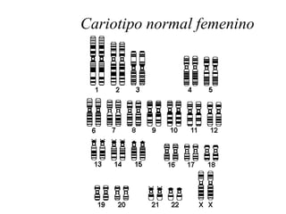 Cariotipo normal femenino
 