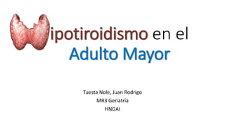 ipotiroidismo en el
Adulto Mayor
Tuesta Nole, Juan Rodrigo
MR3 Geriatría
HNGAI
 