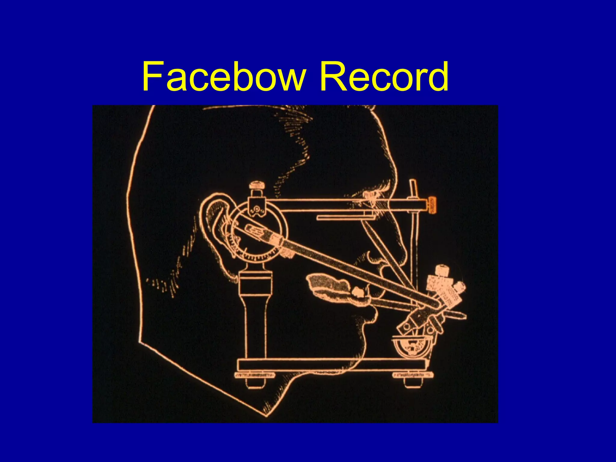 Facebow Record
 