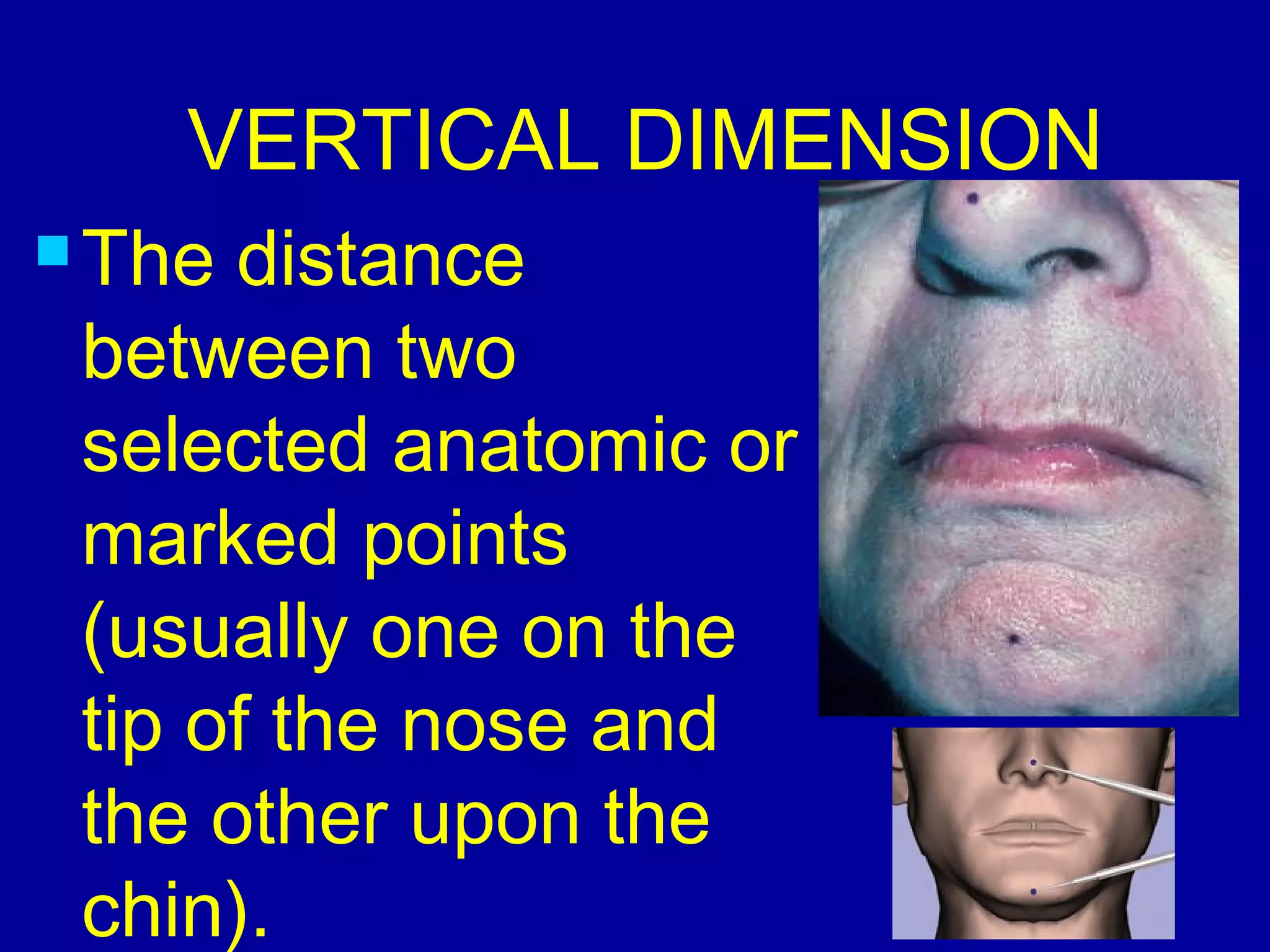 VERTICAL DIMENSION
 The distance
between two
selected anatomic or
marked points
(usually one on the
tip of the nose and
the other upon the
chin).
 