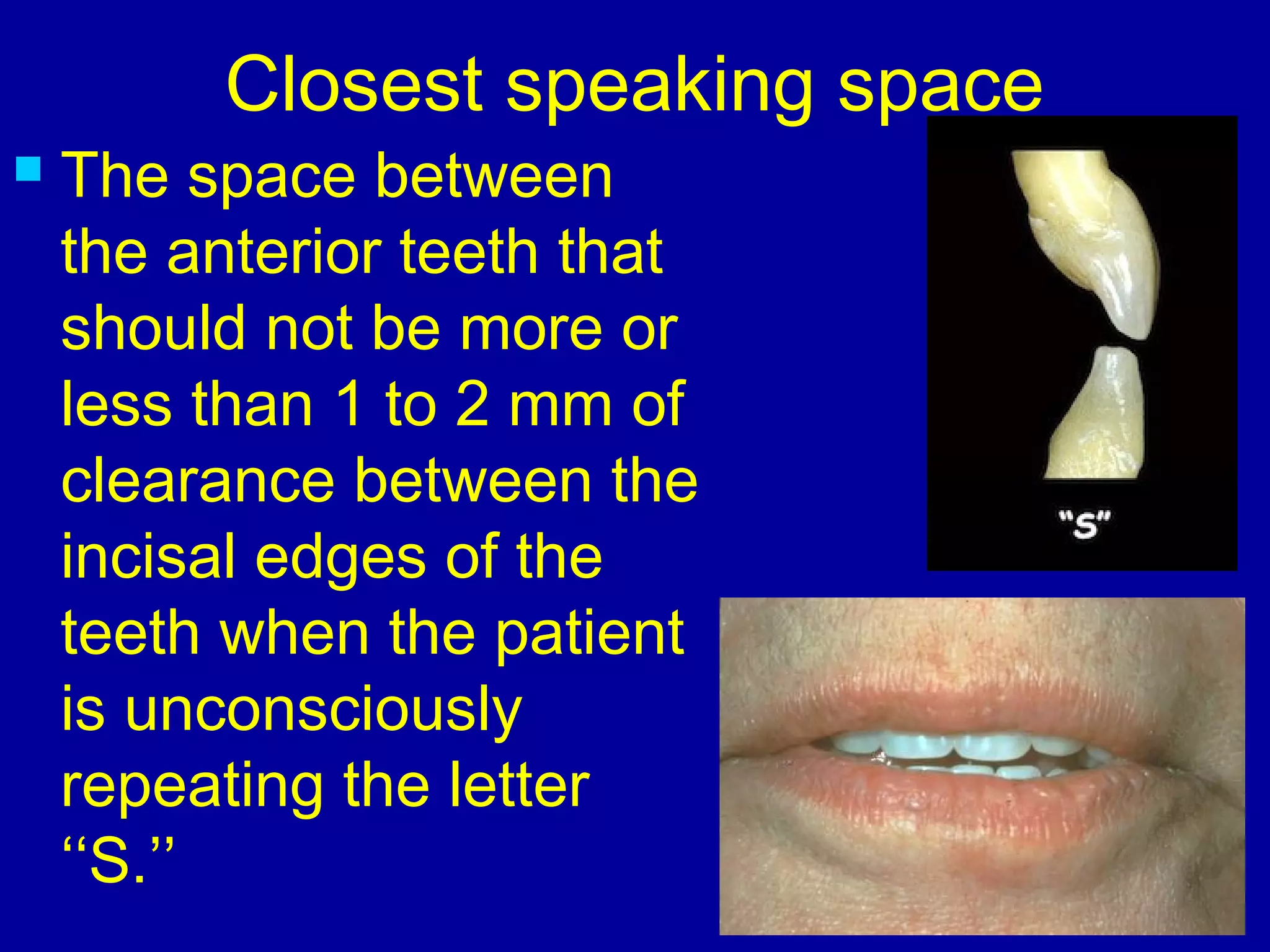 Closest speaking space
 The space between
the anterior teeth that
should not be more or
less than 1 to 2 mm of
clearance between the
incisal edges of the
teeth when the patient
is unconsciously
repeating the letter
‘‘S.’’
 