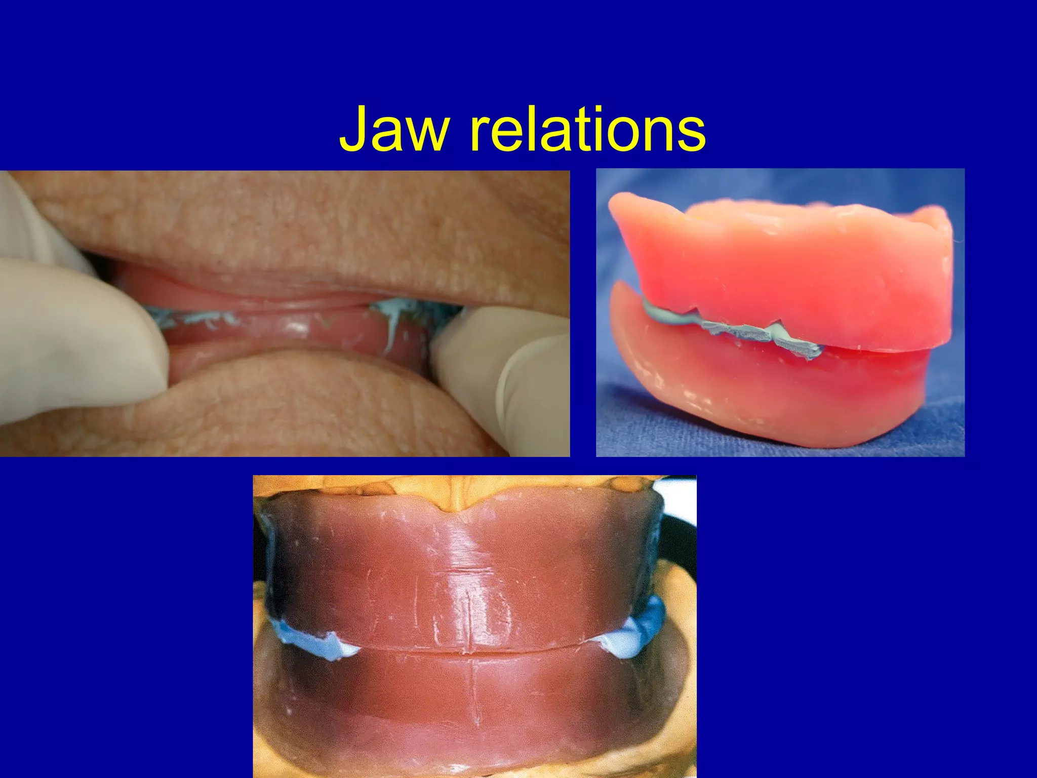 Jaw relations
 