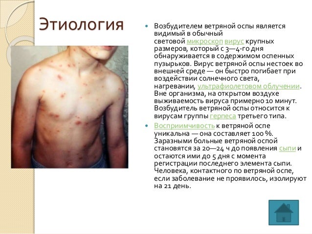 Ветряная оспа