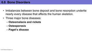 6.8 Bone Disorders
• Imbalances between bone deposit and bone resorption underlie
nearly every disease that affects the human skeleton.
• Three major bone diseases:
– Osteomalacia and rickets
– Osteoporosis
– Paget’s disease
© 2016 Pearson Education, Inc.
 