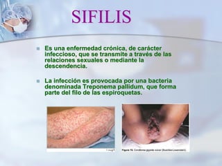 SIFILIS
 Es una enfermedad crónica, de carácter
infeccioso, que se transmite a través de las
relaciones sexuales o mediante la
descendencia.
 La infección es provocada por una bacteria
denominada Treponema pallidum, que forma
parte del filo de las espiroquetas.
 