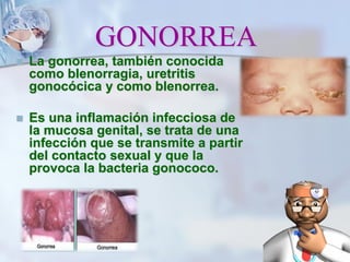 GONORREA
 La gonorrea, también conocida
como blenorragia, uretritis
gonocócica y como blenorrea.
 Es una inflamación infecciosa de
la mucosa genital, se trata de una
infección que se transmite a partir
del contacto sexual y que la
provoca la bacteria gonococo.
 
