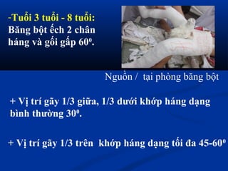 Nguồn / tại phòng băng bột
-Tuổi 3 tuổi - 8 tuổi:
Băng bột ếch 2 chân
háng và gối gấp 600
.
+ Vị trí gãy 1/3 trên khớp háng dạng tối đa 45-600
+ Vị trí gãy 1/3 giữa, 1/3 dưới khớp háng dạng
bình thường 300
.
 