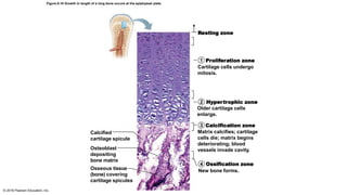 Resting zone
Proliferation zone
Cartilage cells undergo
mitosis.
Hypertrophic zone
Older cartilage cells
enlarge.
Calcification zone
Matrix calcifies; cartilage
cells die; matrix begins
deteriorating; blood
vessels invade cavity.
Calcified
cartilage spicule
Ossification zone
New bone forms.Osseous tissue
(bone) covering
cartilage spicules
Osteoblast
depositing
bone matrix
Figure 6.10 Growth in length of a long bone occurs at the epiphyseal plate.
© 2016 Pearson Education, Inc.
1
2
3
4
 