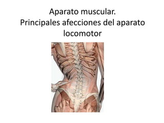 Aparato muscular.
Principales afecciones del aparato
locomotor
 