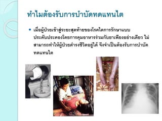 ทาไมต้องรับการบาบัดทดแทนไต
 เมื่อผู้ป่วยเข้าสู่ระยะสุดท้ายของโรคไตการรักษาแบบ
ประคับประคองโดยการคุมอาหารร่วมกับยาเพียงอย่างเดียว ไม่
สามารถทาให้ผู้ป่วยดารงชีวิตอยู่ได้ จึงจาเป็นต้องรับการบาบัด
ทดแทนไต
 
