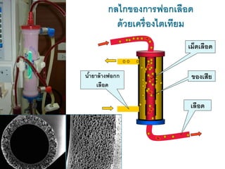 กลไกของการฟอกเลือด
ด้วยเครื่องไตเทียม
เลือด
น้ายาล้างฟอกก
เลือด
ของเสีย
เม็ดเลือด
 