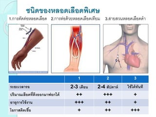 ชนิดของหลอดเลือดพิเศษ
1.การตัดต่อหลอดเลือด 2.การต่อด้วยหลอดเลือดเทียม 3.สายสวนหลอดเลือดดา
1 2 3
ระยะเวลารอ 2-3 เดือน 2-4 สัปดาห์ ใช้ได้ทันที
ปริมาณเลือดที่ดึงออกมาฟอกได้ ++ +++ +
อายุการใช้งาน +++ ++ +
โอกาสติดเชื้อ + ++ +++
 