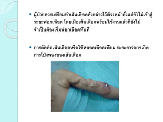  ผู้ป่วยควรเตรียมทาเส้นเลือดดังกล่าวไว้ล่วงหน้าตั้งแต่ยังไม่เข้าสู่
ระยะฟอกเลือด โดยเมื่อเส้นเลือดพร้อมใช้งานแล้วก็ยังไม่
จาเป็นต้องเริ่มฟอกเลือดทันที
 การตัดต่อเส้นเลือดหรือใช้หลอดเลือดเทียม ระยะยาวอาจเกิด
การโป่งพองของเส้นเลือด
 