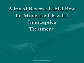 A Fixed Reverse Labial BowA Fixed Reverse Labial Bow
for Moderate Class IIIfor Moderate Class III
InterceptiveInterceptive
TreatmentTreatment
www.indiandentalacademy.com
 