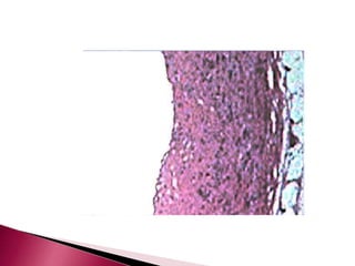 6. cvs | PPTX