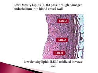 HDL
HDL
HDL
LDL
LDL
LDL
O
O
 