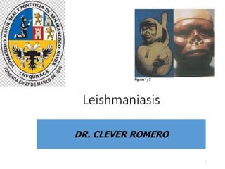 Leishmaniasis
1
DR. CLEVER ROMERO
 