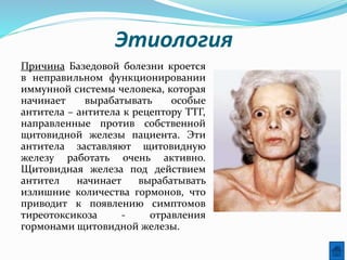 Этиология
Причина Базедовой болезни кроется
в неправильном функционировании
иммунной системы человека, которая
начинает вырабатывать особые
антитела – антитела к рецептору ТТГ,
направленные против собственной
щитовидной железы пациента. Эти
антитела заставляют щитовидную
железу работать очень активно.
Щитовидная железа под действием
антител начинает вырабатывать
излишние количества гормонов, что
приводит к появлению симптомов
тиреотоксикоза - отравления
гормонами щитовидной железы.
 