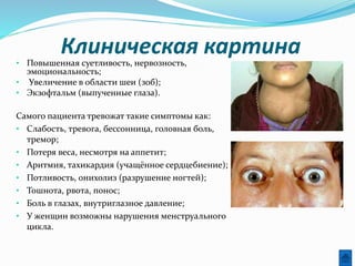 Клиническая картина• Повышенная суетливость, нервозность,
эмоциональность;
• Увеличение в области шеи (зоб);
• Экзофтальм (выпученные глаза).
Самого пациента тревожат такие симптомы как:
• Слабость, тревога, бессонница, головная боль,
тремор;
• Потеря веса, несмотря на аппетит;
• Аритмия, тахикардия (учащённое сердцебиение);
• Потливость, онихолиз (разрушение ногтей);
• Тошнота, рвота, понос;
• Боль в глазах, внутриглазное давление;
• У женщин возможны нарушения менструального
цикла.
 
