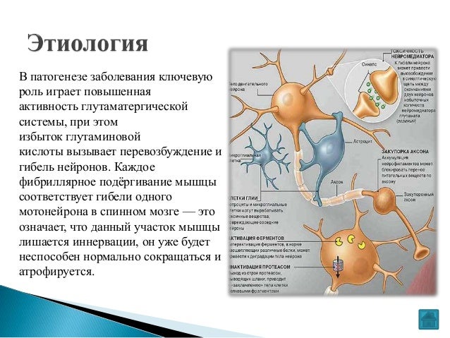 Болезнь моторного нейрона мкб