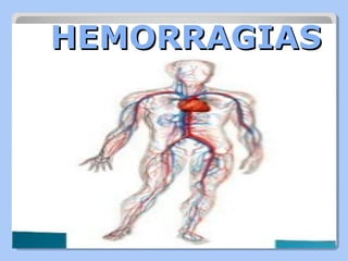 HEMORRAGIASHEMORRAGIAS
 