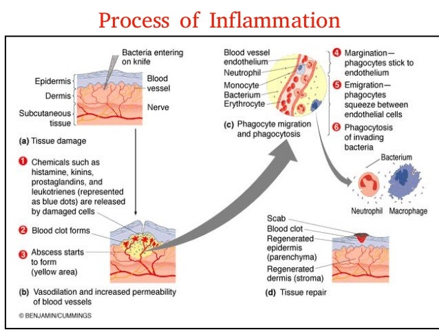 6. inflammation