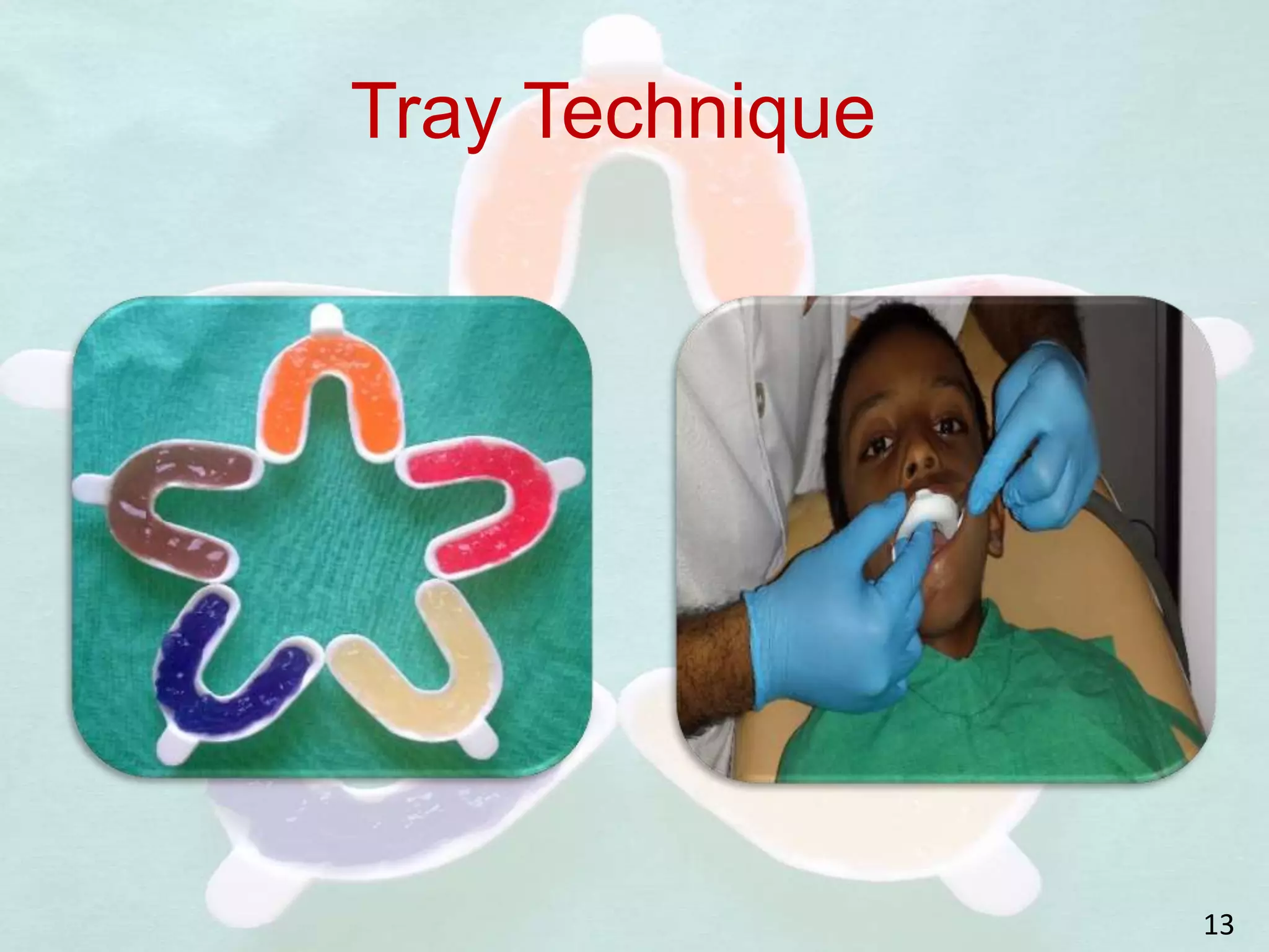 Tray Technique
13
 