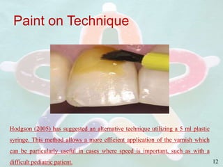 Paint on Technique
12
Hodgson (2005) has suggested an alternative technique utilizing a 5 ml plastic
syringe. This method allows a more efficient application of the varnish which
can be particularly useful in cases where speed is important, such as with a
difficult pediatric patient.
 