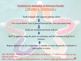Procedure for application of Stannous Flouride
[ Muhler’s Technique ]
Teeth cleaned with aqueous pumice slurry
Un-waxed dental floss is passed between the inter-proximal areas.
Teeth are isolated and dried with air.
SnF2 is applied using the paint on technique and the solution is kept for 4
minutes.
Repeat applications are made every 6 months or more frequently if patients is
susceptible to caries.
20
Ref: MS Muthu, Pediatric dentistry principles and practice, 2nd edition,2011; pg:155-159,
Elsevier publication.
Ref: J.J.Murray, Fluorides in caries prevention, 3rd edition, 1999; pg:179-207,Butterworth-
 