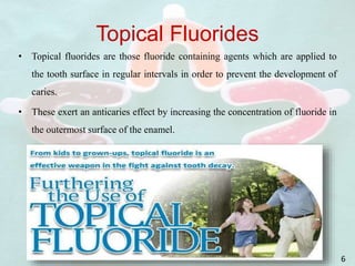 Topical Fluorides
6
• Topical fluorides are those fluoride containing agents which are applied to
the tooth surface in regular intervals in order to prevent the development of
caries.
• These exert an anticaries effect by increasing the concentration of fluoride in
the outermost surface of the enamel.
 
