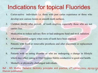 Indications for topical Fluorides
1. Caries-active individuals i.e. those with past caries experience or those who
develop new carious lesion on smooth tooth surfaces.
2. Children shortly after periods of tooth eruption, especially those who are not
carries free.
3. Medication to reduce salivary flow or had undergone head and neck radiation.
4. After periodontal surgery when roots of teeth have been exposed.
5. Patients with fixed or removable prosthesis and after placement or replacement
of restorations.
6. Patients with an eating disorder or who are undergoing a change in lifestyle
which may affect eating or Oral Hygiene Habits conductive to good oral health.
7. Mentally or physically challenged individuals.
Ref : MS Muthu, Pediatric dentistry principles and practice, 2nd edition,2011; pg:155-159
Elsevier publication. 7
 
