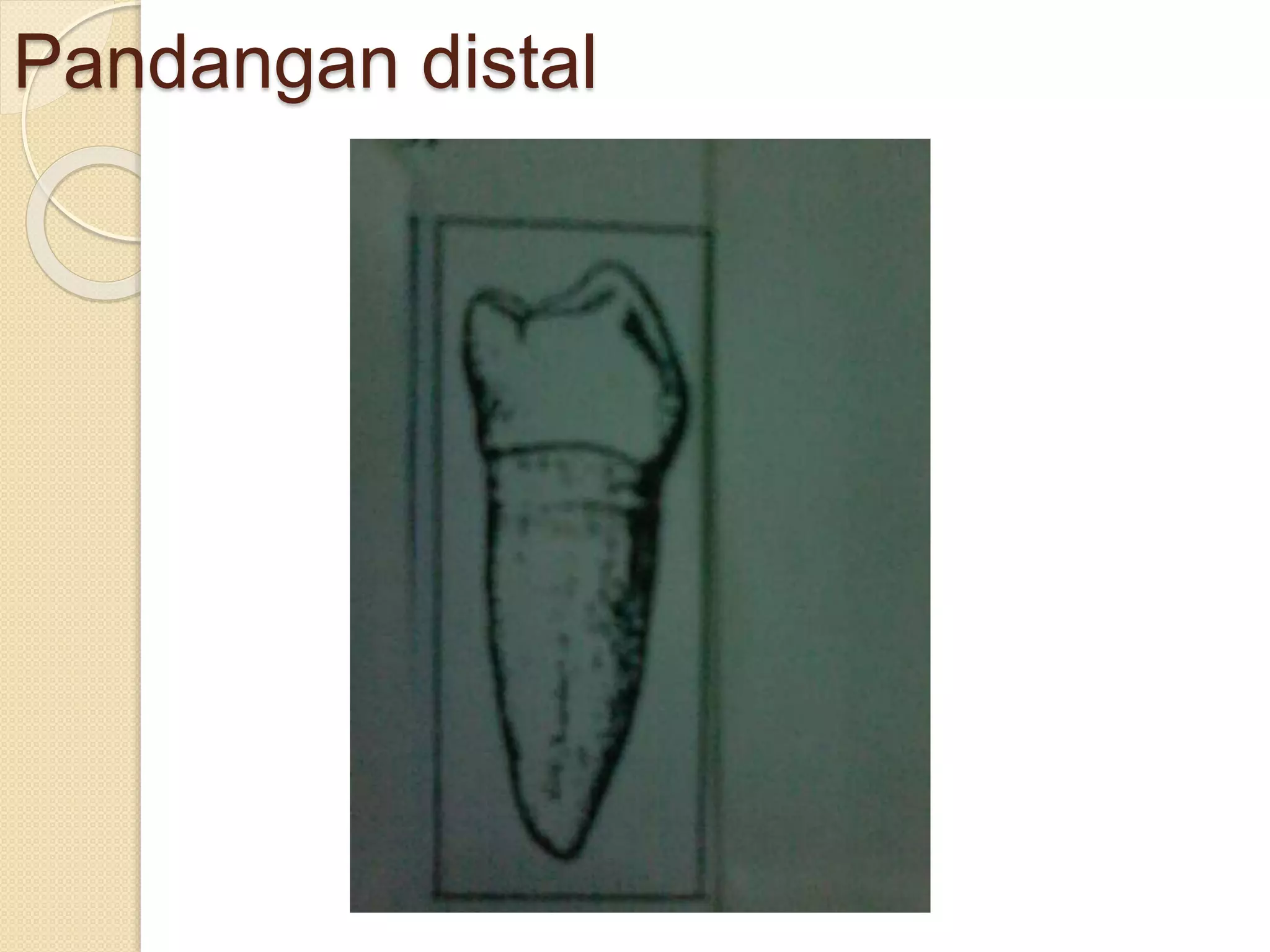 6. anatomi gigi premolar 1 & 2 bawah | PPTX
