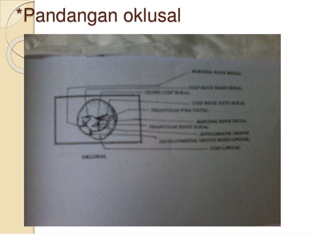 6. anatomi gigi premolar 1 & 2 bawah