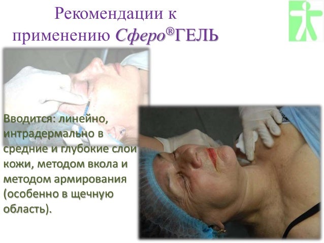 сферогель применение в косметологии