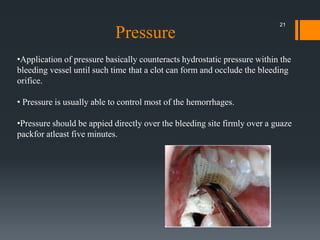 •Application of pressure basically counteracts hydrostatic pressure within the
bleeding vessel until such time that a clot can form and occlude the bleeding
orifice.
• Pressure is usually able to control most of the hemorrhages.
•Pressure should be appied directly over the bleeding site firmly over a guaze
packfor atleast five minutes.
Pressure
21
 