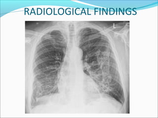 RADIOLOGICAL FINDINGS
 
