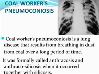 COAL WORKER'S
PNEUMOCONIOSIS
Coal worker's pneumoconiosis is a lung
disease that results from breathing in dust
from coal over a long period of time.
It was formally called anthracosis and
anthraco-silicosis when it occurred
together with silicosis.
 